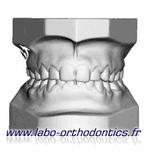 numerisation 3D moulages orthodontie